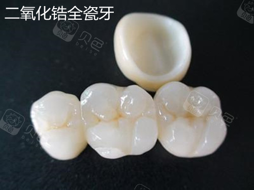 二氧化锆全瓷牙价格表，与自然美景对话，探寻内心宁静之旅